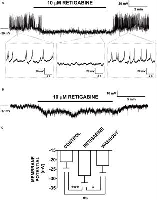 Detrusor Smooth Muscle KV7 Channels: Emerging New Regulators of Urinary Bladder Function